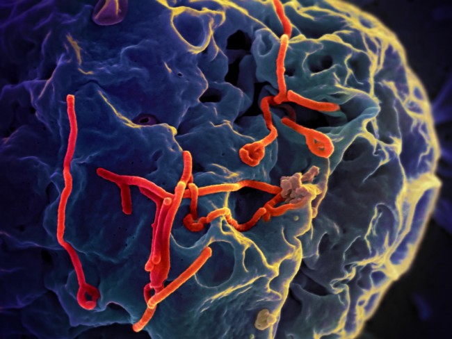 epitelial cell from the kidney of a monkey being infected with ebola